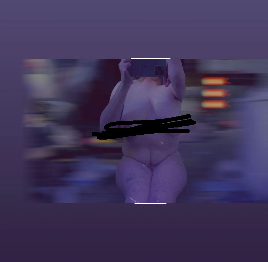 25f bilateral amputee, clubbed arm, read bottom text out of hospital again!