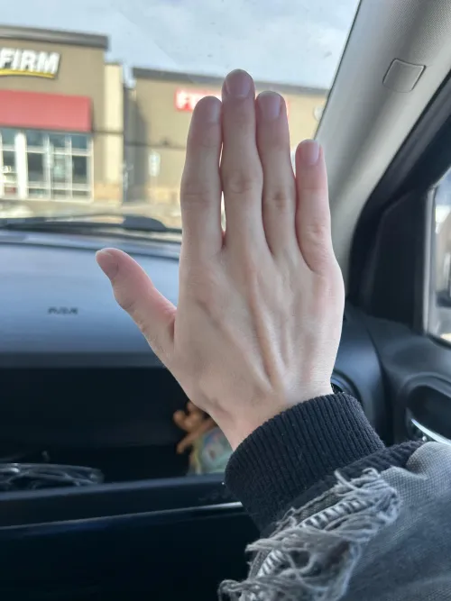 Why are my fingers so gapped? My left hand doesn’t have it as bad.