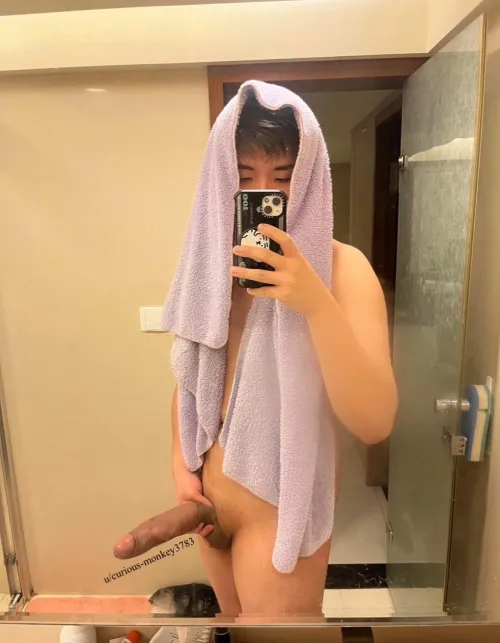 Very swollen post NNN