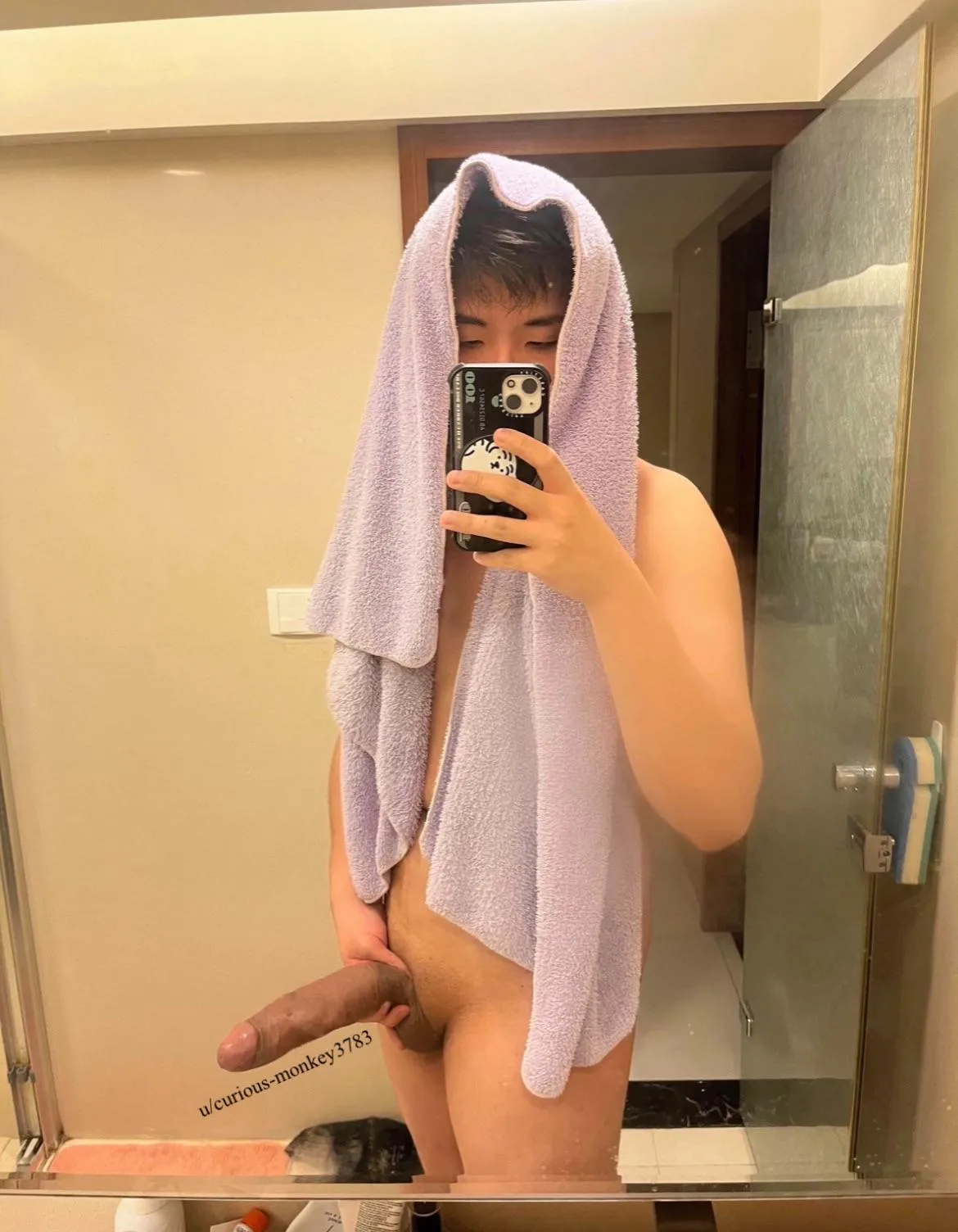 Very swollen post NNN