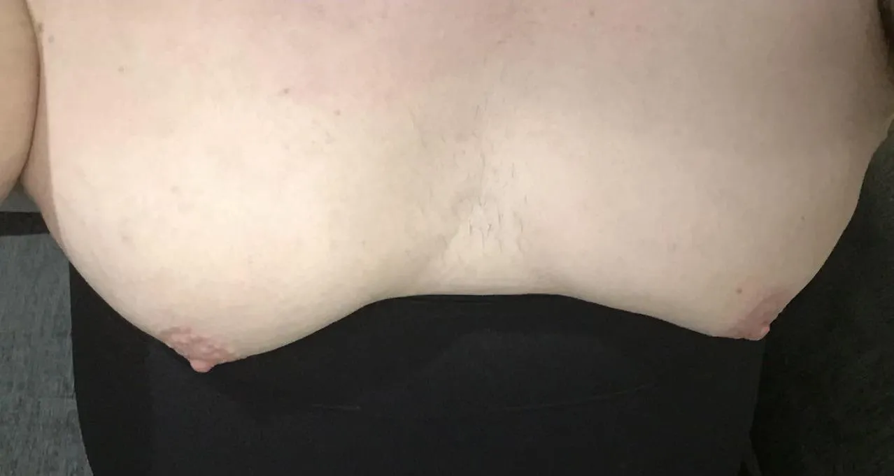 Fat disgusting udders…