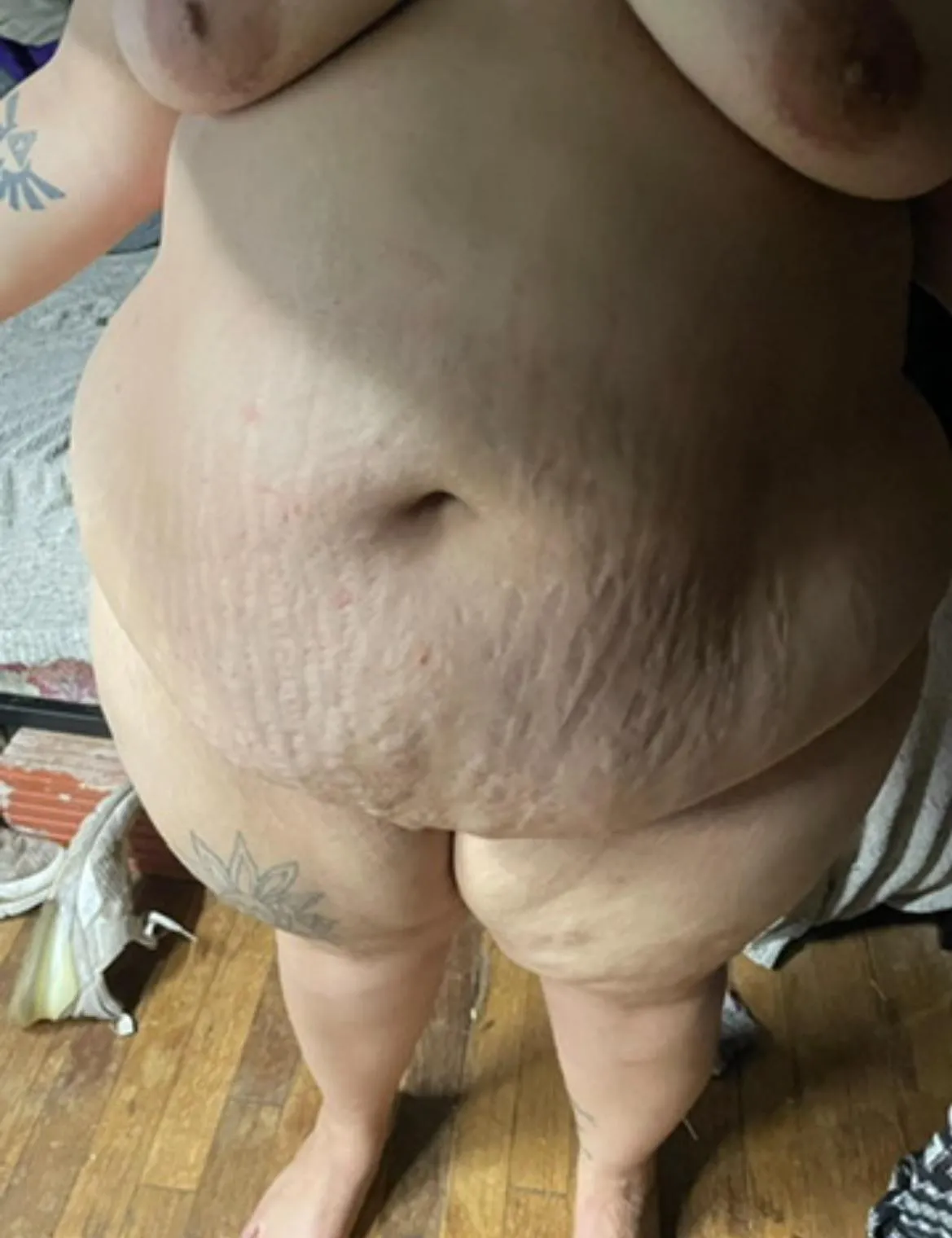 Big belly covered in tiger stripes