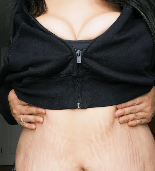 Upvote if you love belly beauty marks