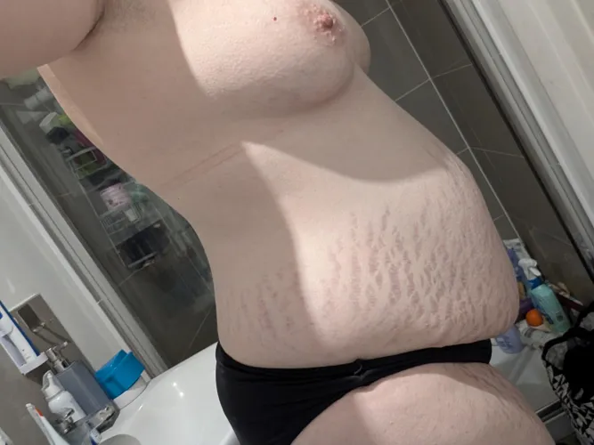 I never knew there was so much love for stretchmarks before this subreddit 💓