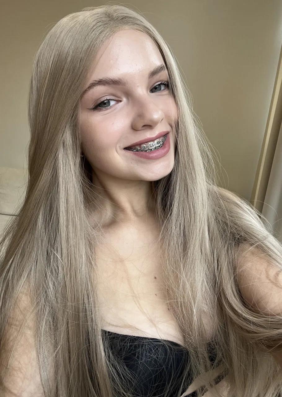 trying to seduce you with my braces