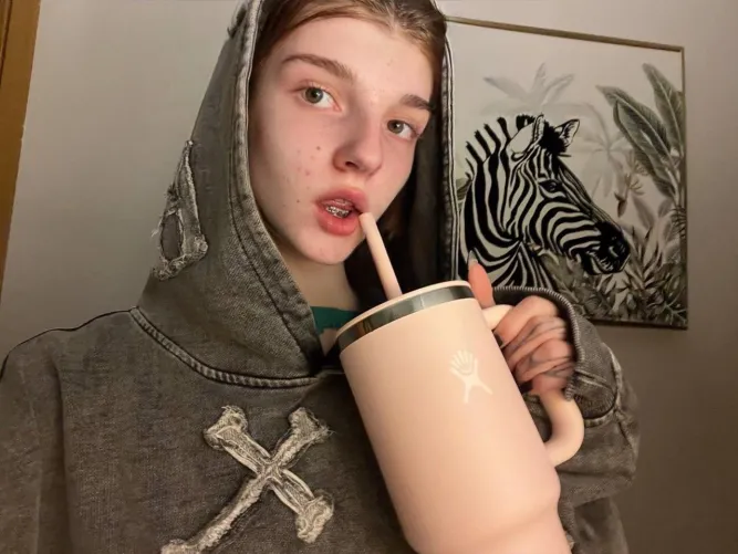 would you kiss me with these braces on?