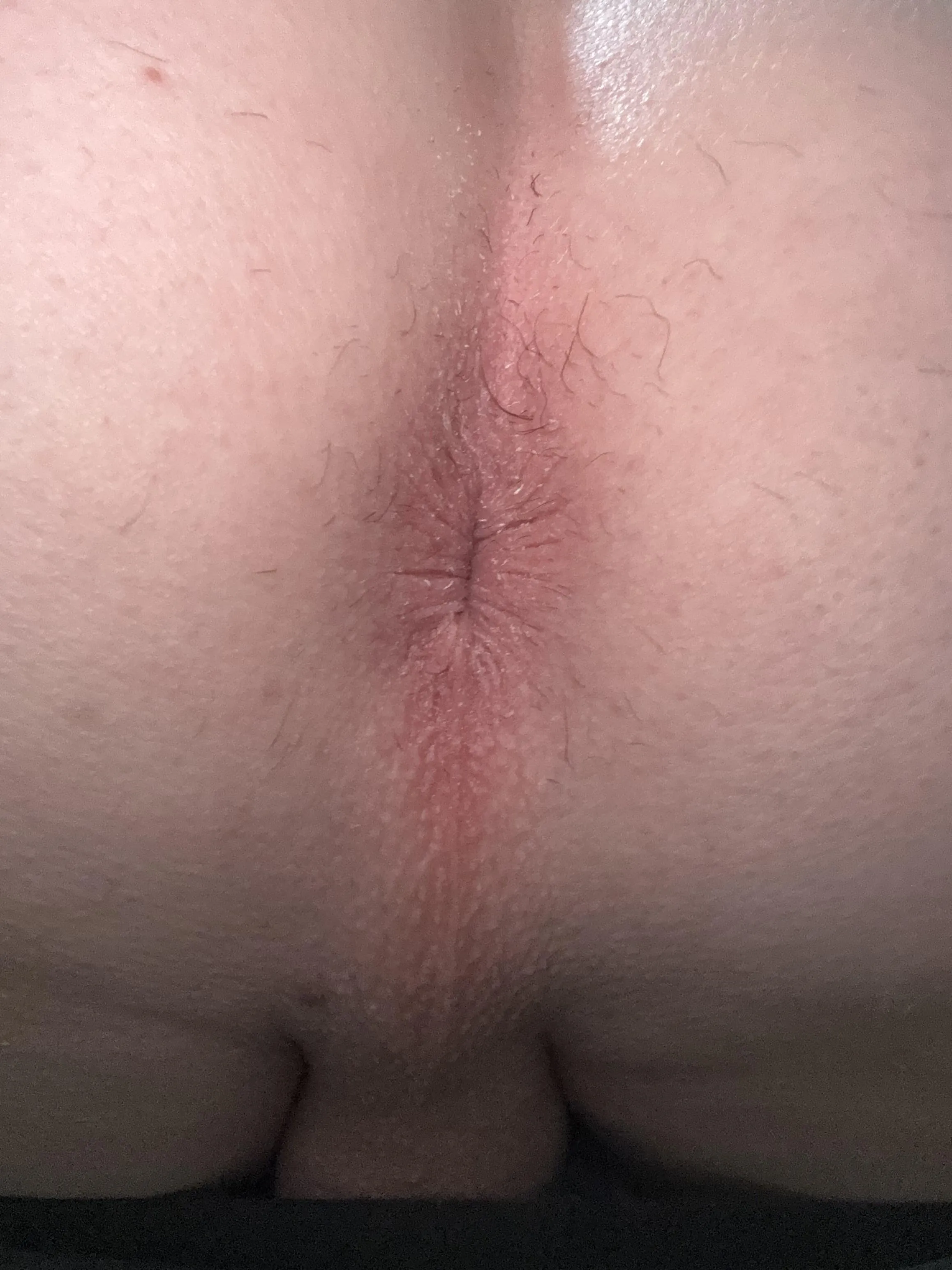 Day 2 of posting my hole M age [34]