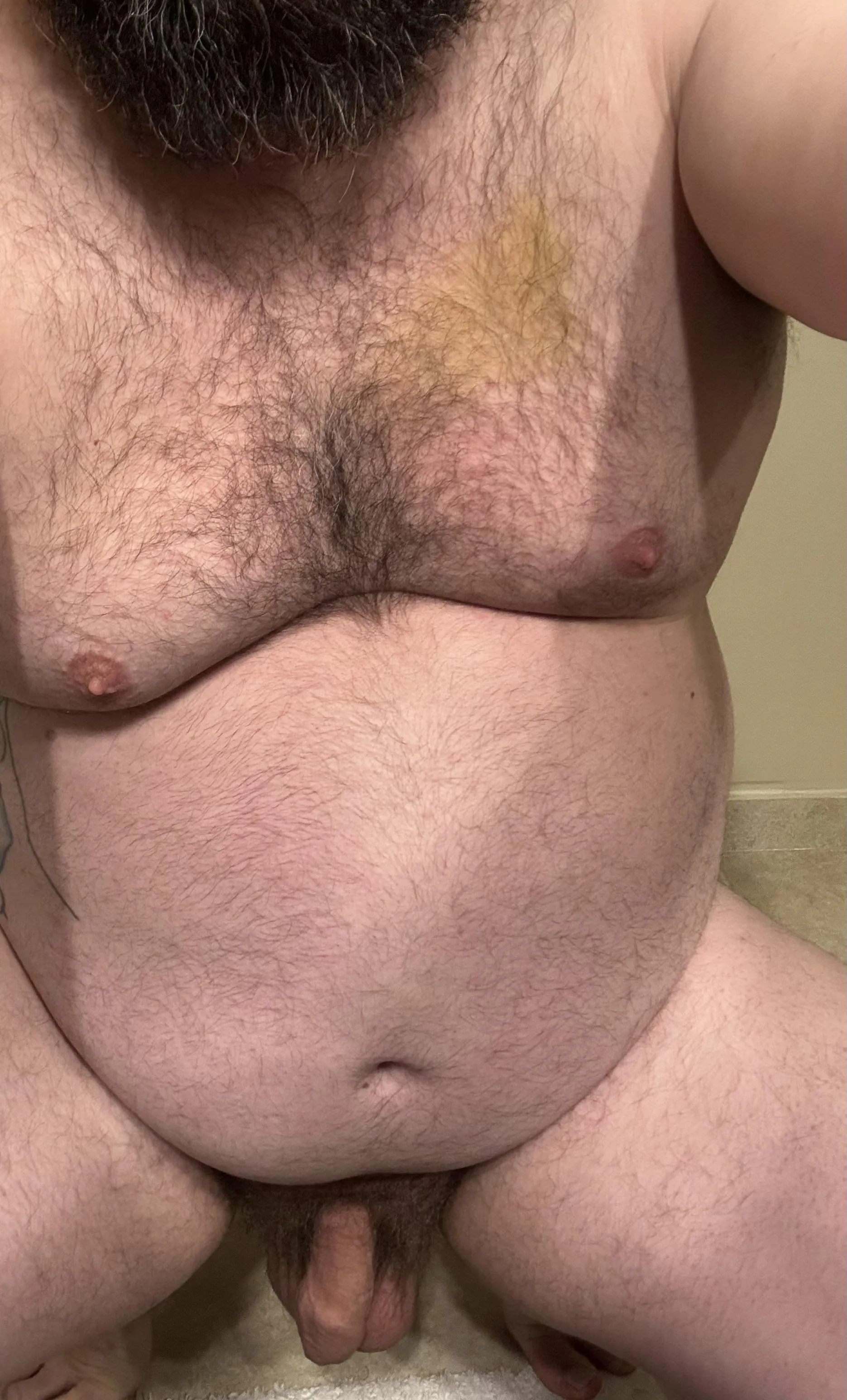 Didn’t realize how big that bruise was lol.