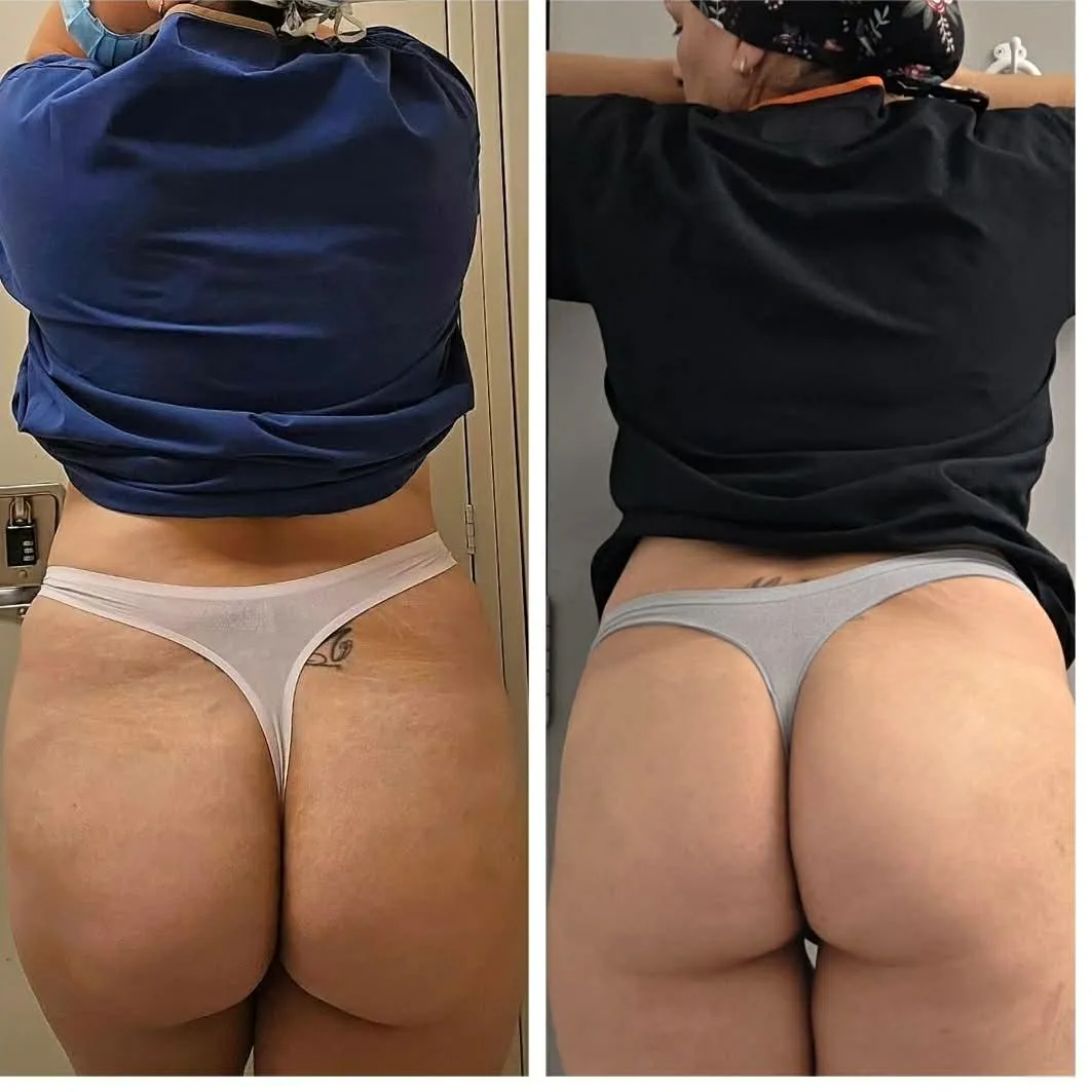 SCRUB booty progress