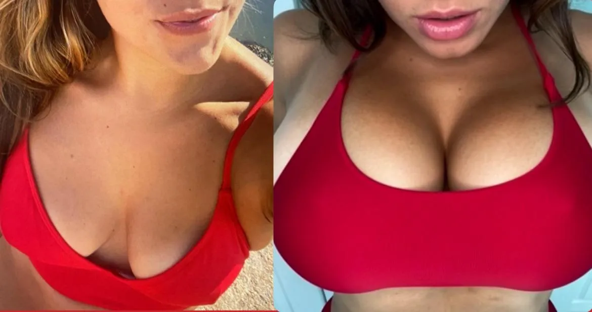 Swollen tits snd bigger lips