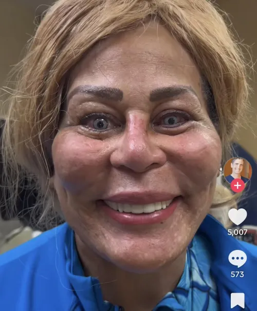 Eye color change aside, her other cosmetic procedures are somehow an equal tragedy