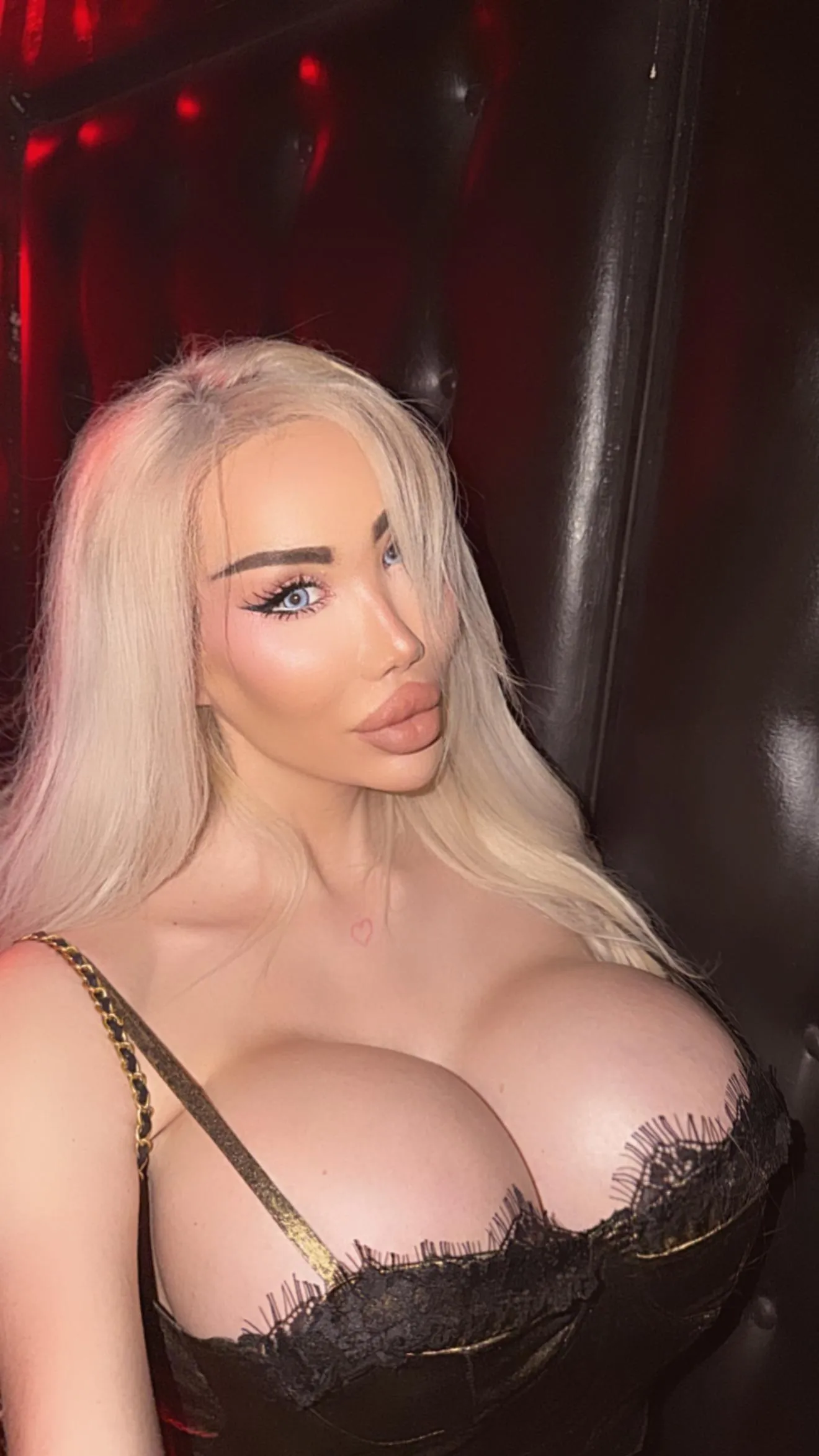 For 2026 I want manufacturers to bring back 2000cc implant shells and more doctors willing to do xxl sizes