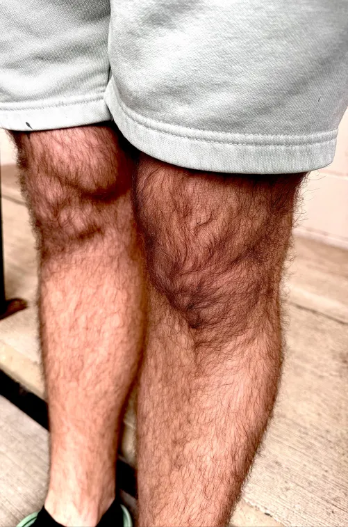 My hairy knees.