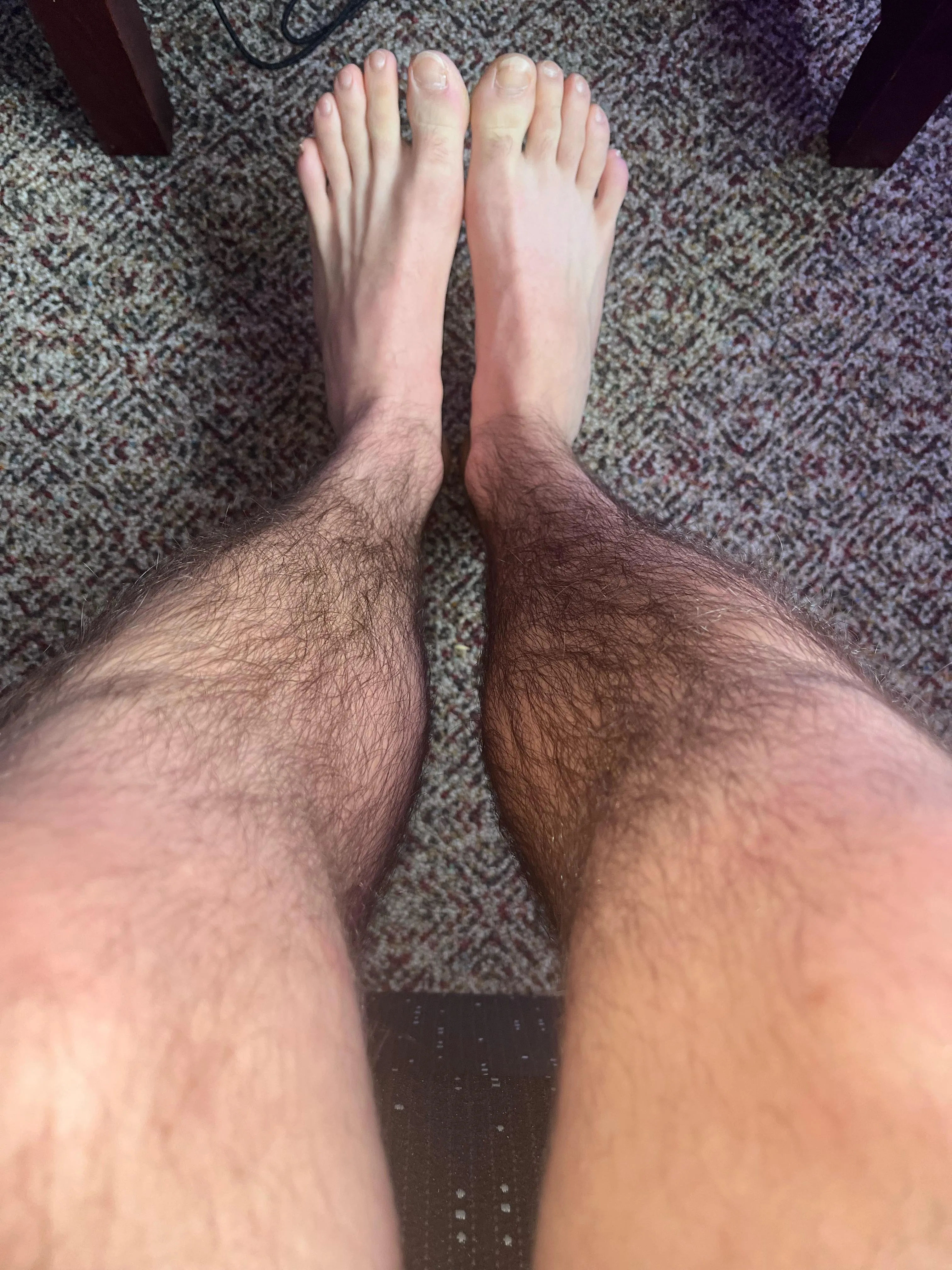 You love my hairy legs