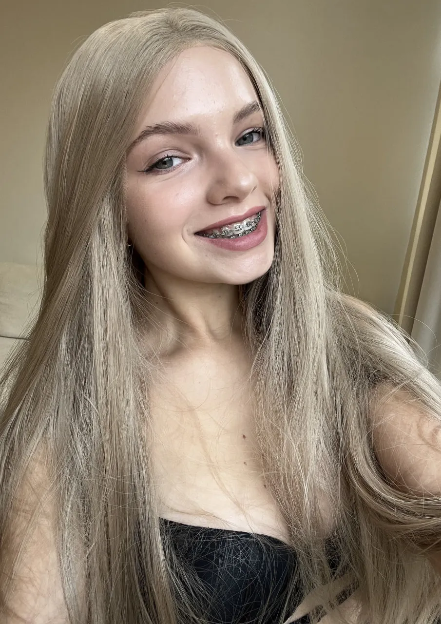 Am I attractive with braces?