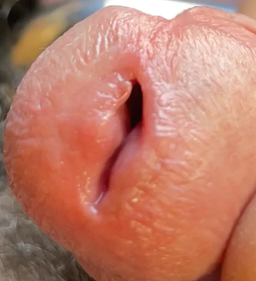 My peehole after a 11mm stretch.