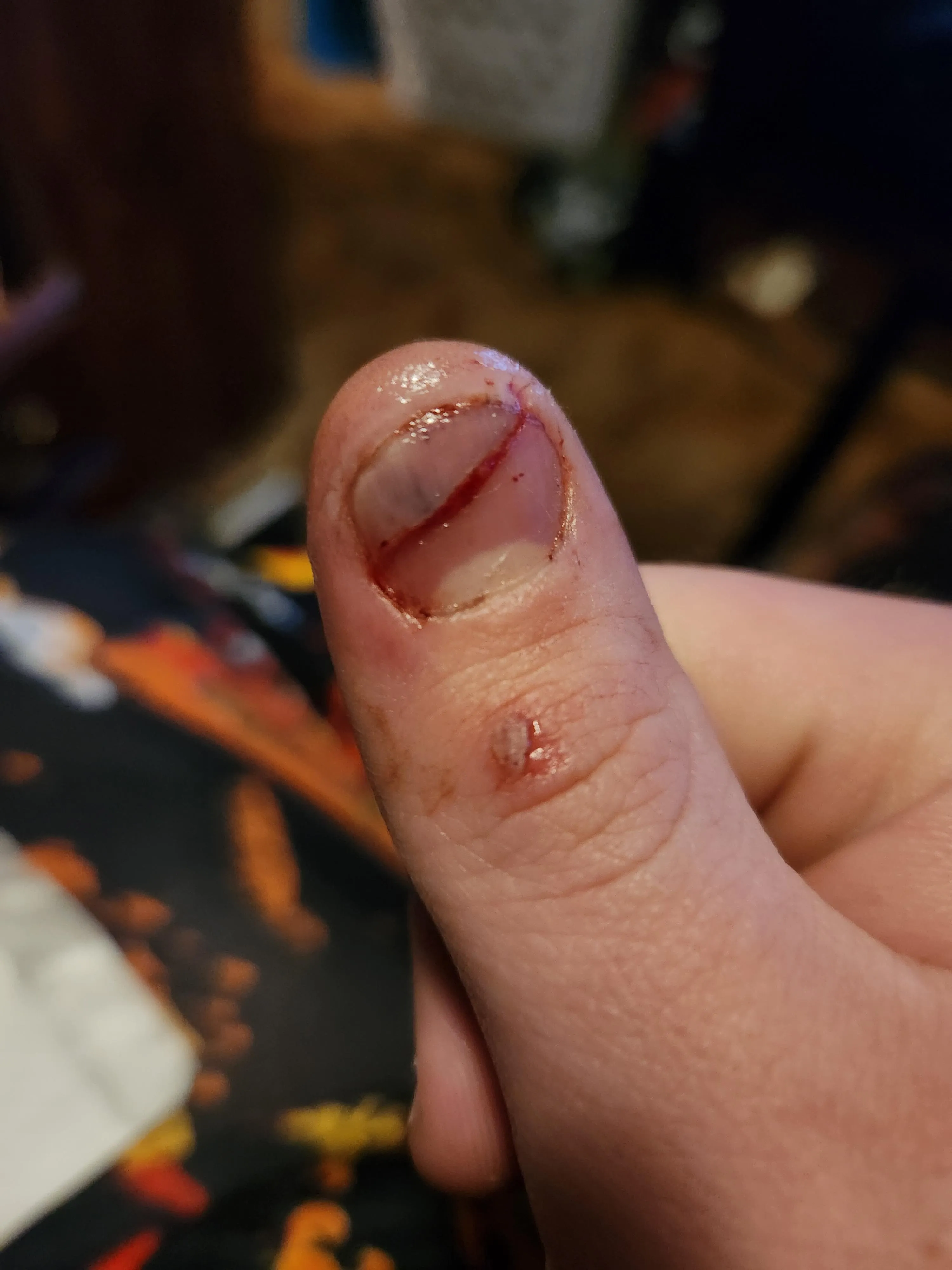 I split My nail in two today...