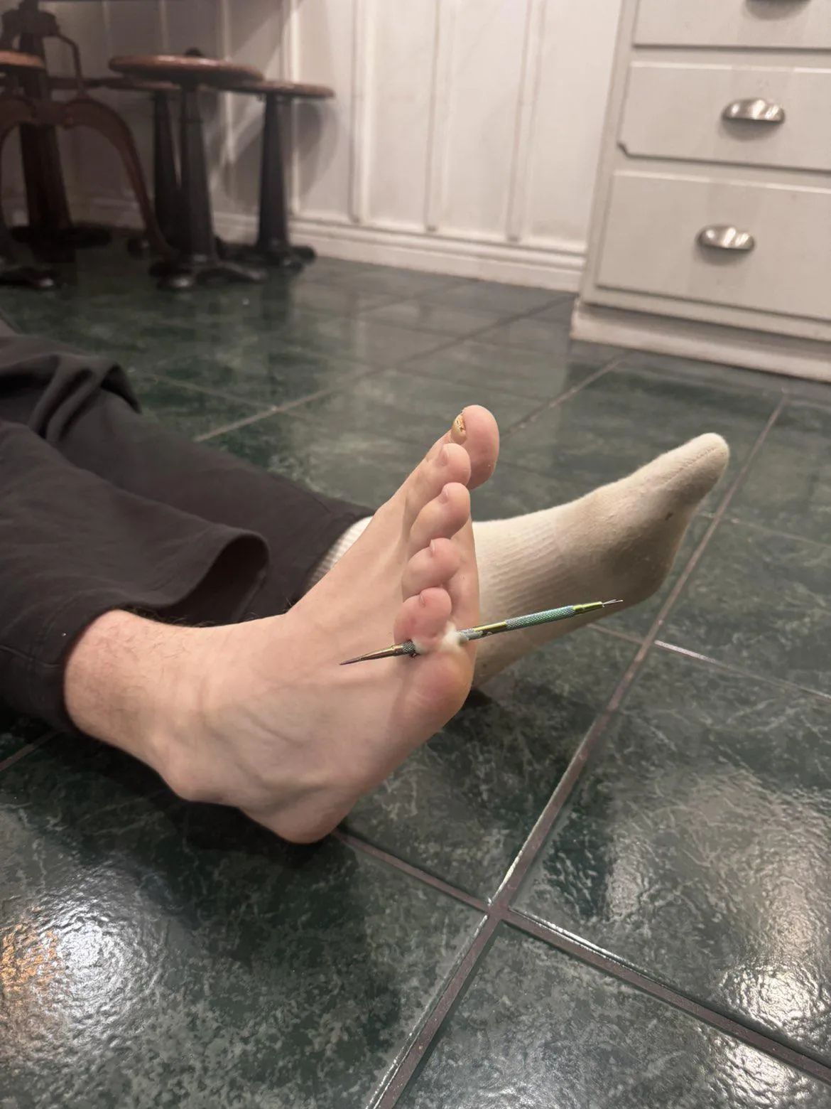 Sculpting needle through foot