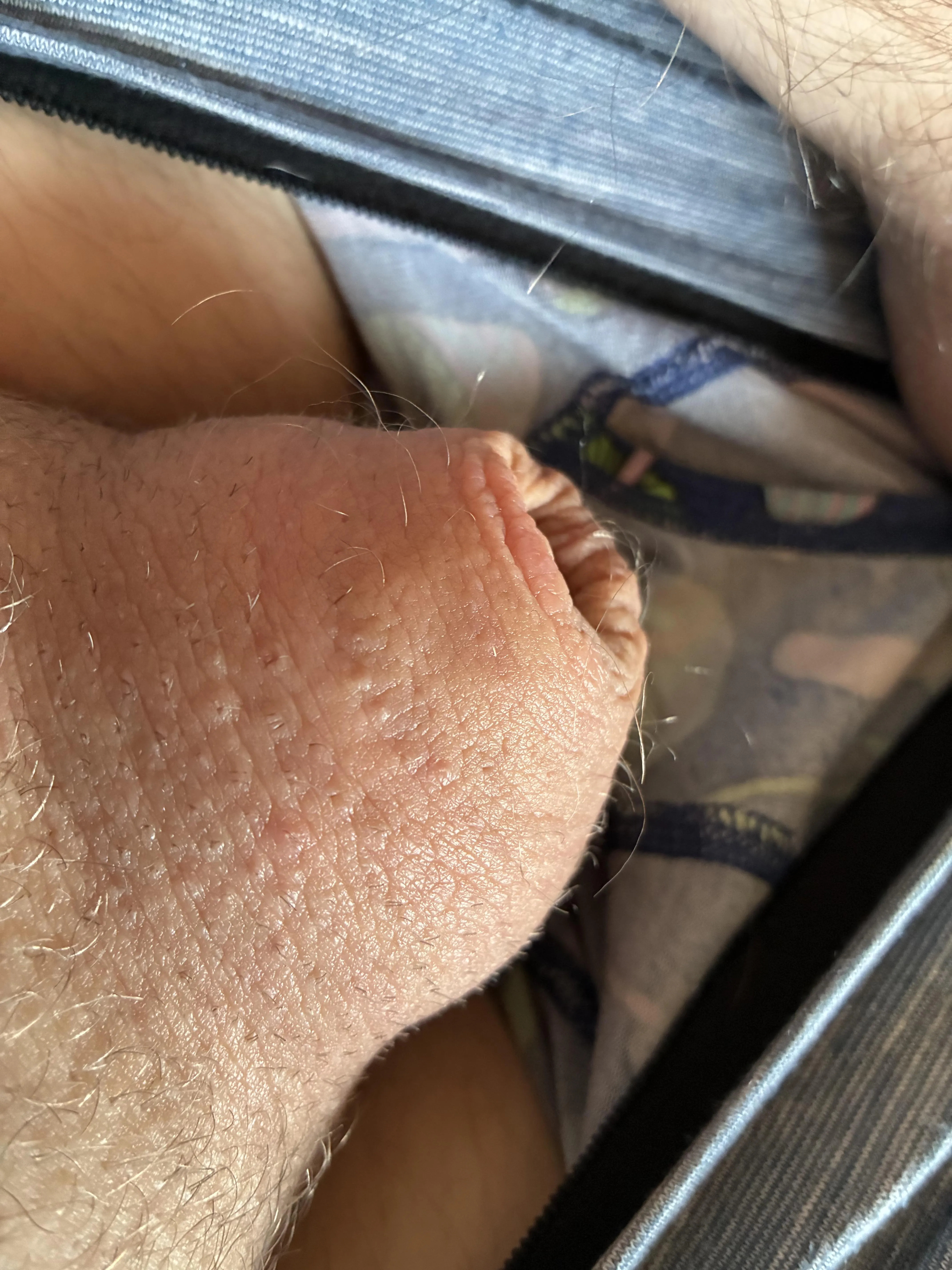 1.8” Pear Retainer FTW