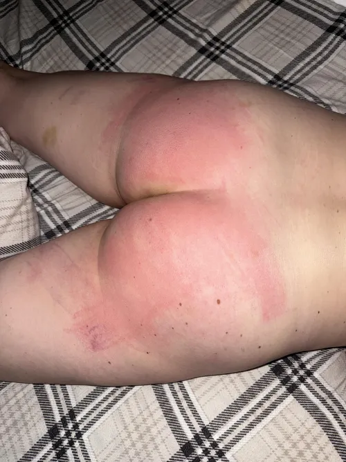 The pain and bruises are my reward for being a good girl 🥰