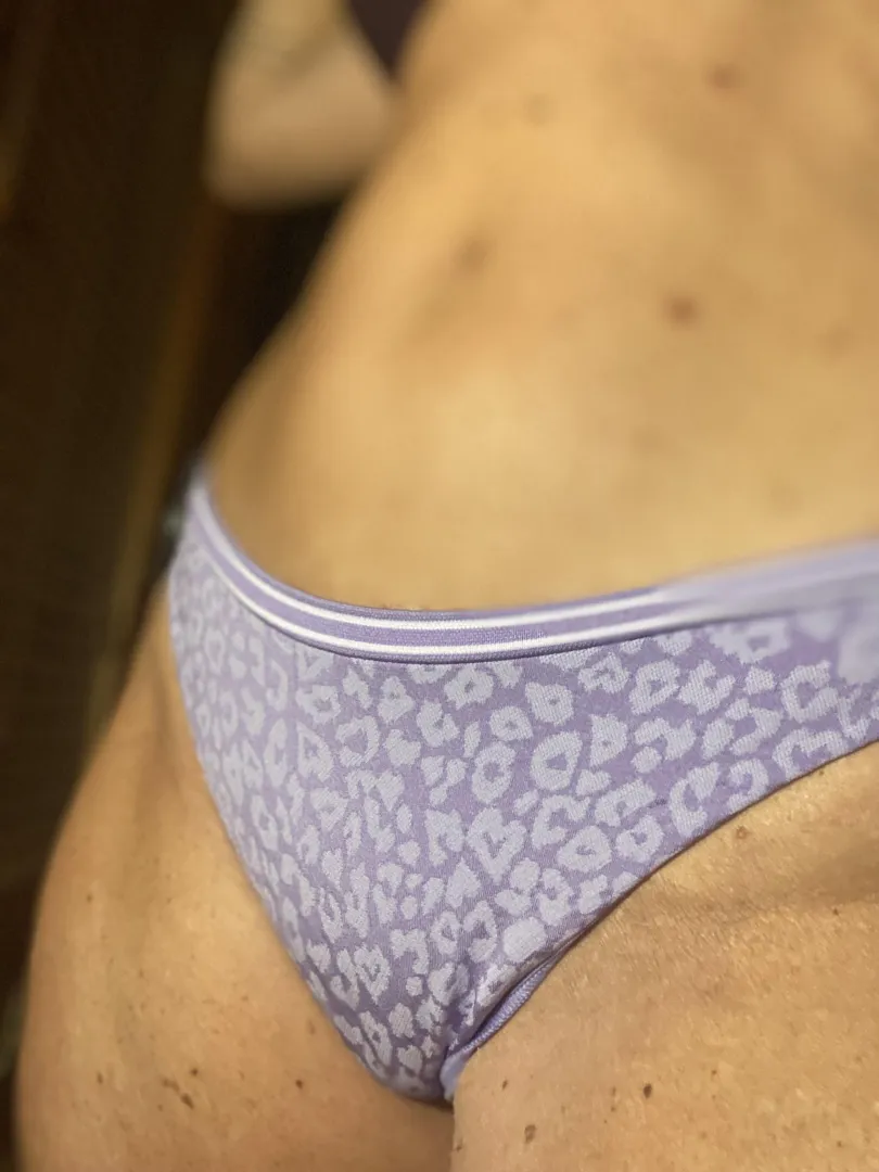 Did you even notice the freckles ?