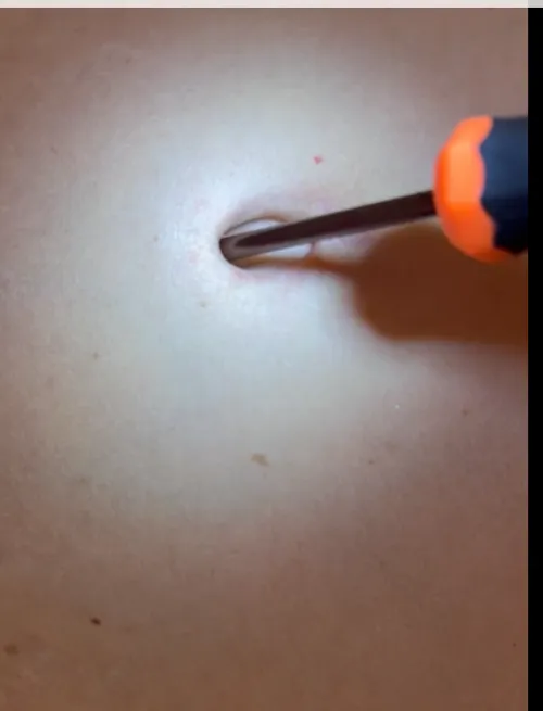 Bellybutton screwed