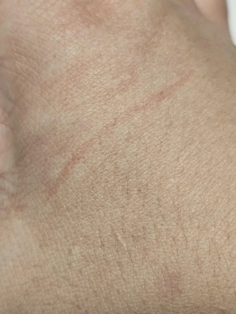 Playing with my cat, a tooth grazed my hand. I don't think the skin broke. Looking for reassurance.