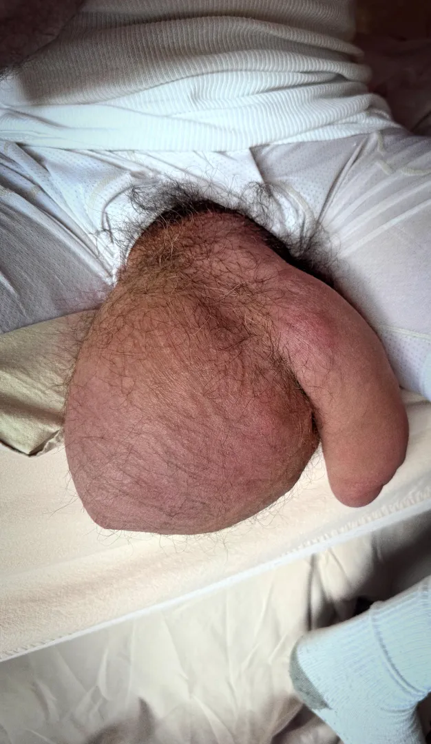 [31] Massive low hangers