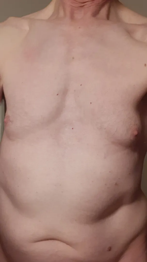 7 months and poor growth