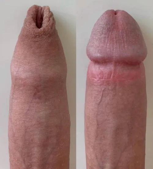 Found this before&after online, can I realistically expect results like this for myself?