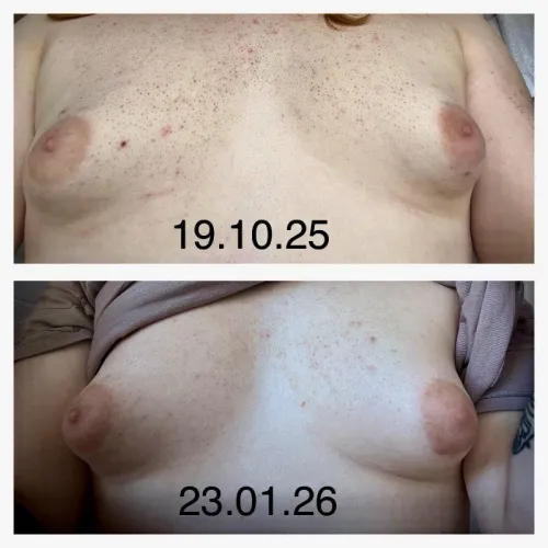 HRT Update: 6 Months In