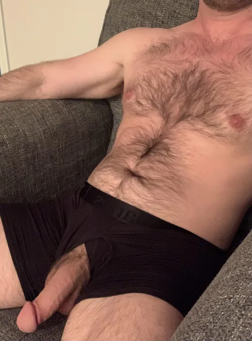 If you saw your friend like this, would you stare?