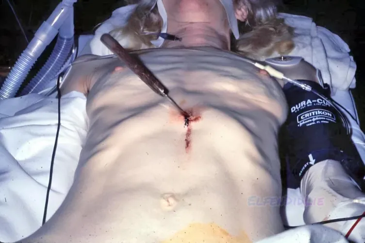 Woman stabbed in her abdomen