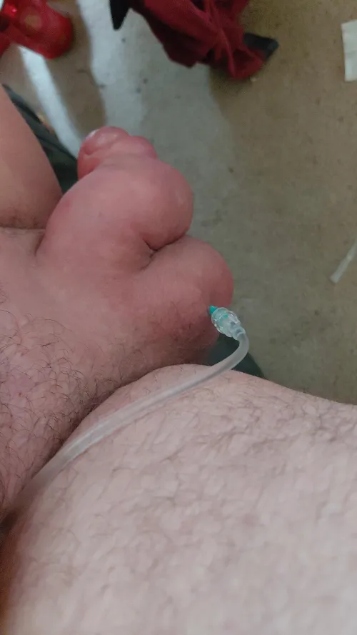 Better do it quick fill 