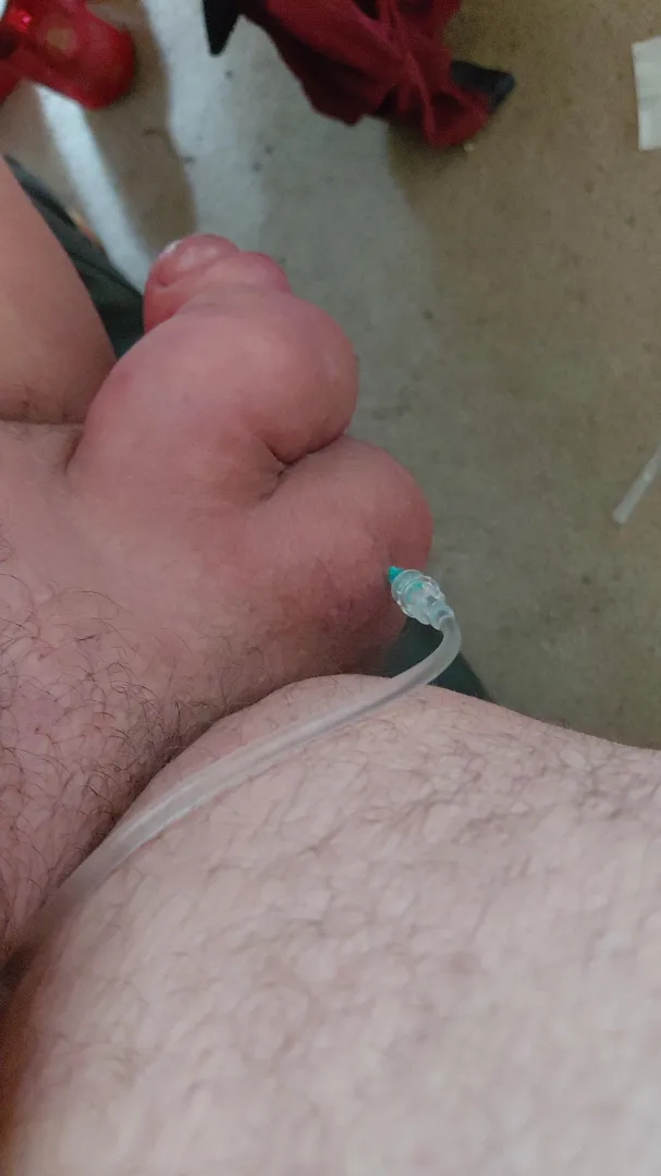 Better do it quick fill 