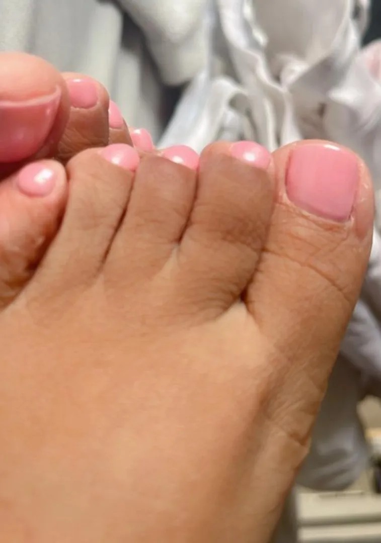 These toes look like candy. Wanna know how they taste