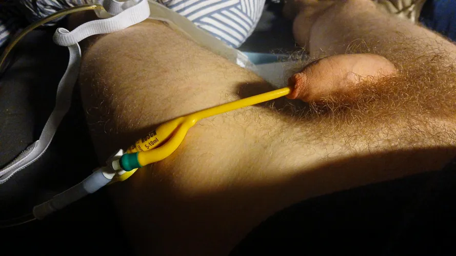 Are there any Dutch people with a catheter in this group?