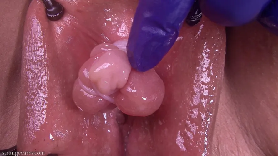 can you even tell it's a clit anymore?  pumped and tied up with rubber bands [nb]