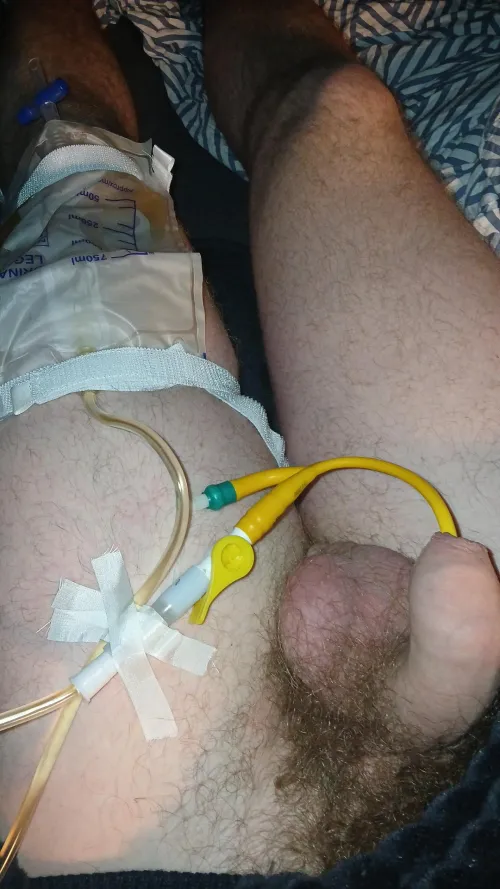 leg bag is nice here so you don't have to carry so much weight i think I'm hooked