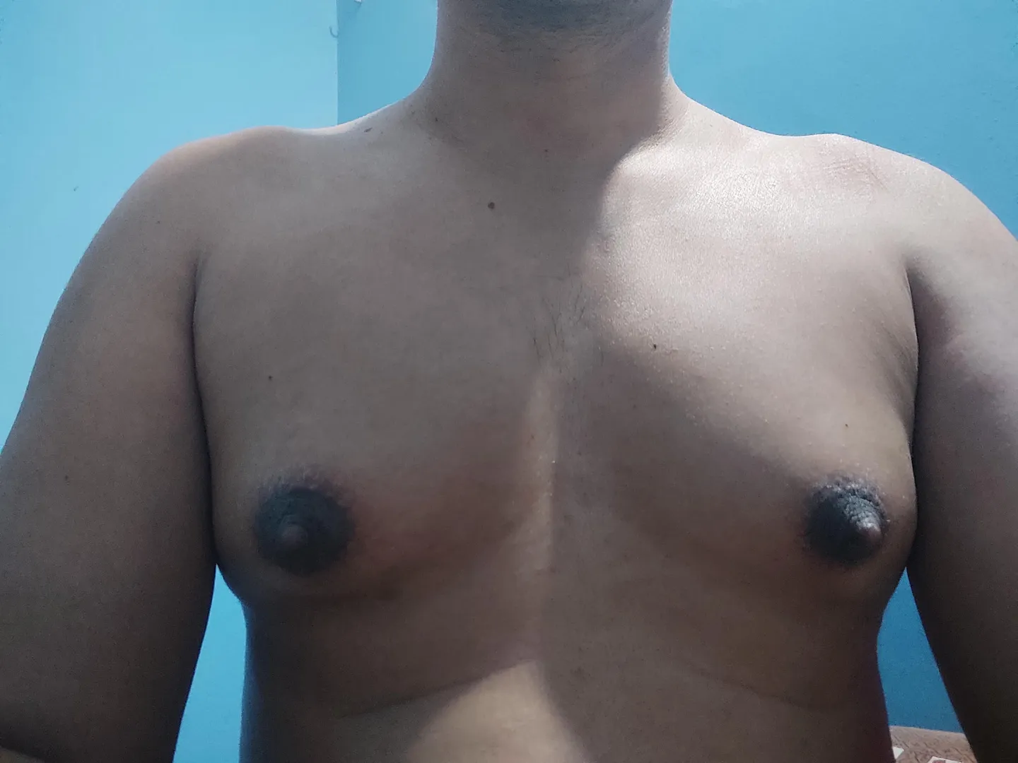 Started at 29. Currently am 33. on hrt on and off.What tanner stage is this. What is the cup size any guess!!