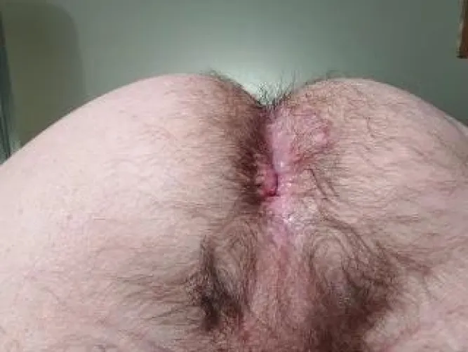 Do you think there is hope?