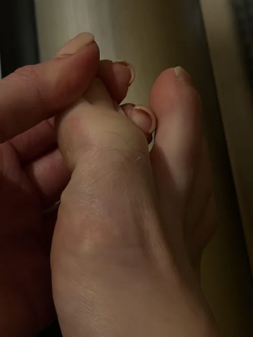 Can you keep my secret? I secretly have hairy toes!