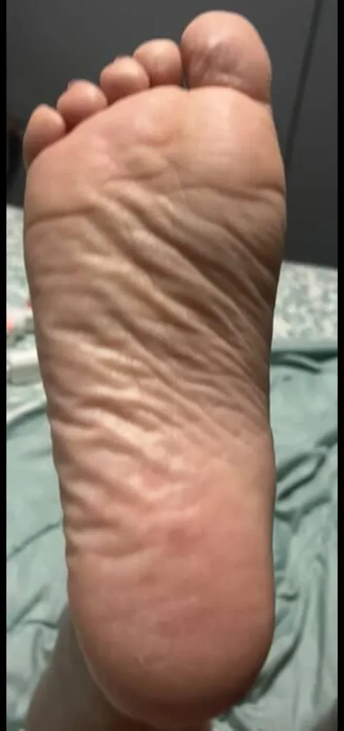 Congratulations! My wrinkly soles are out and You're on wrinkle counting duty.