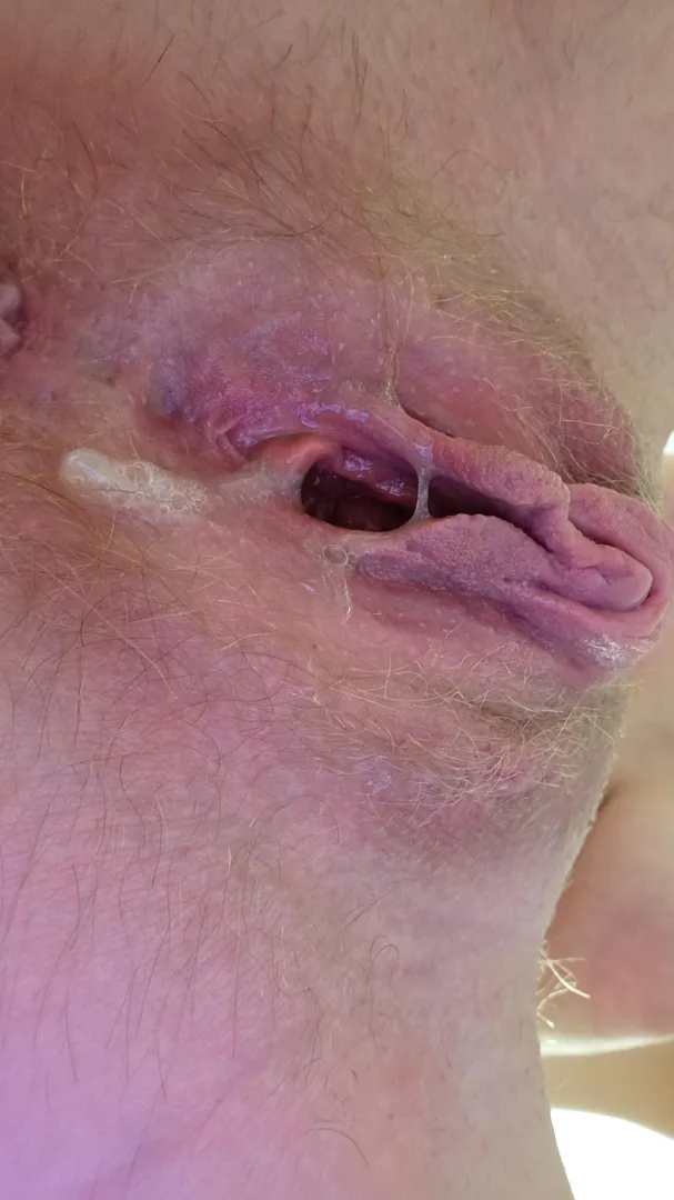 Got my hole filled up again