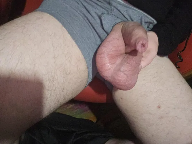 What do you think about hyperballs ?