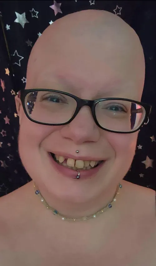 bald and lost in the stars tonight 