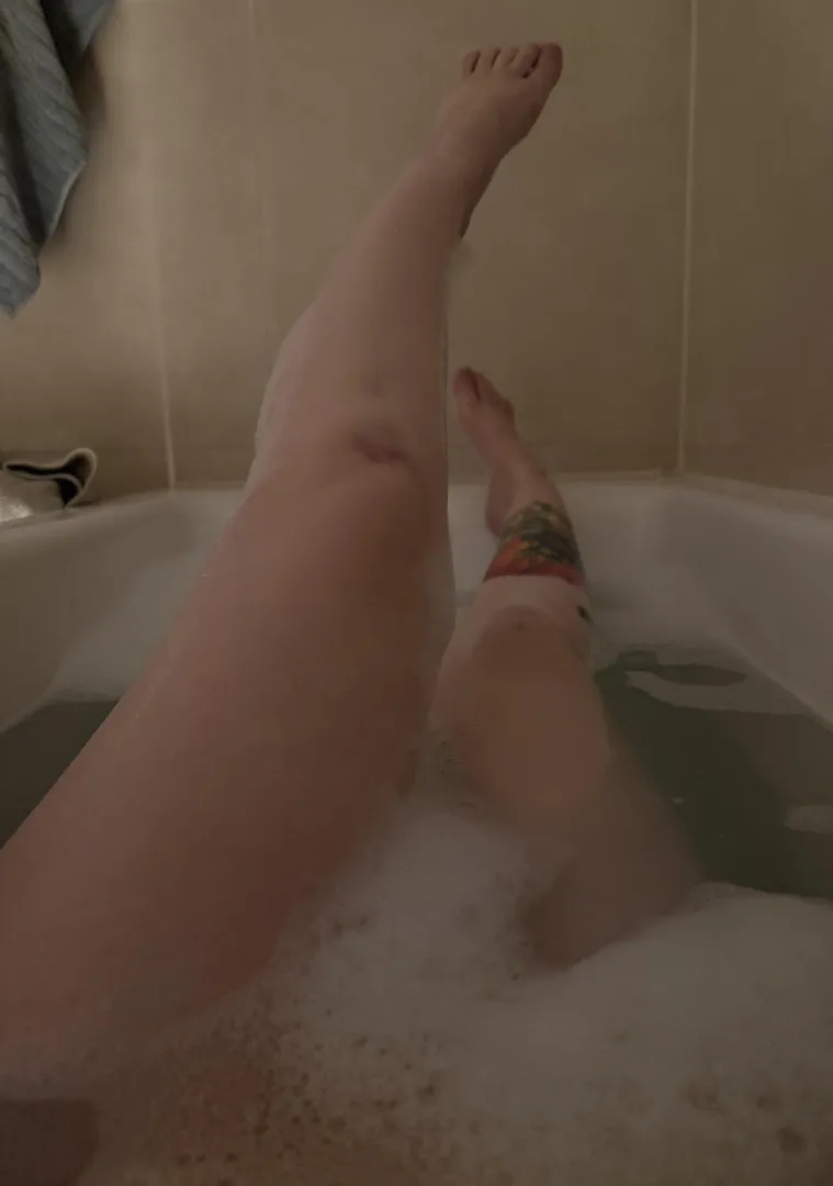 I’ve got to say that it hurts