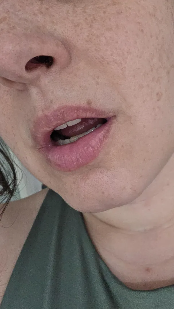 That freckle above my upper lip