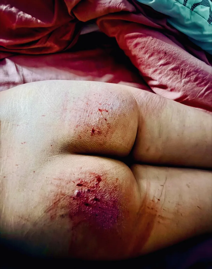 (TW: blood) Lesson learnt, accountability always leaves a mark