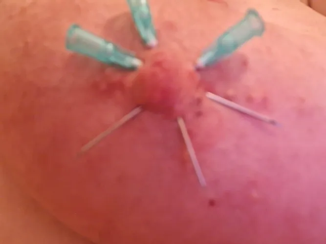 Little needle flower